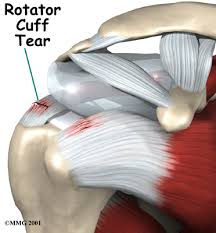 Riabilitazione post operatoria